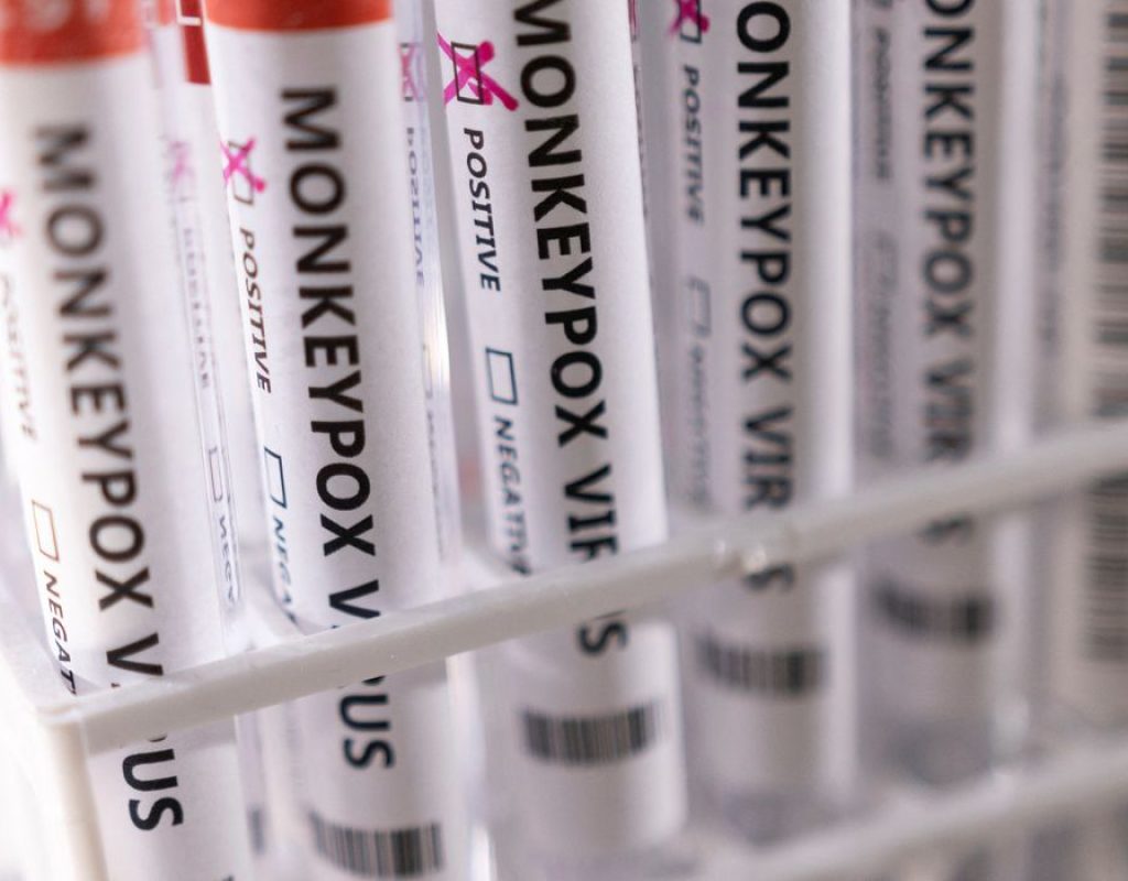 2022-05-23t222423z_1_lynxnpei4m100_rtroptp_4_health-monkeypox_1