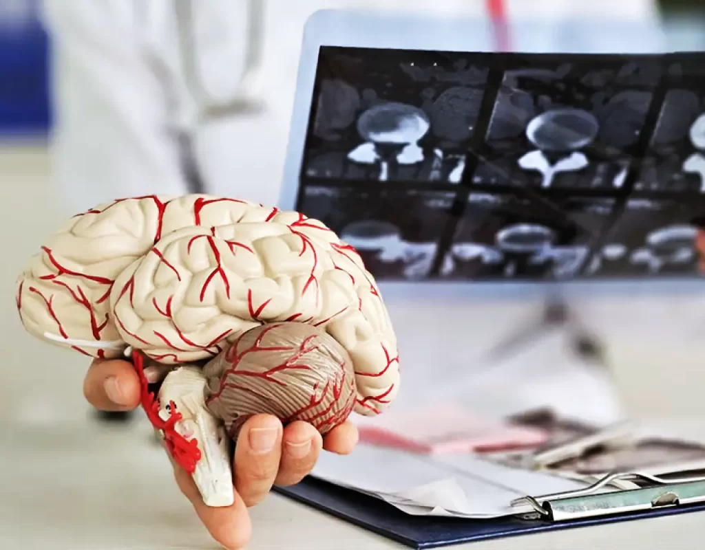 Alzheimer