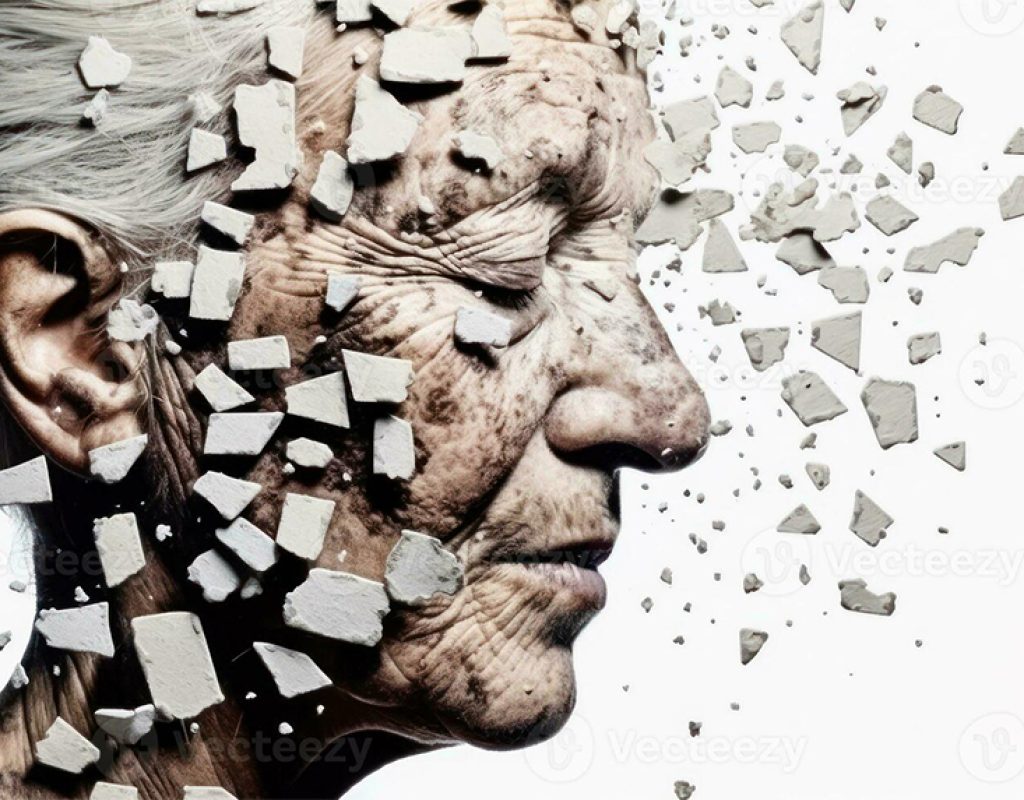 Alzheimer