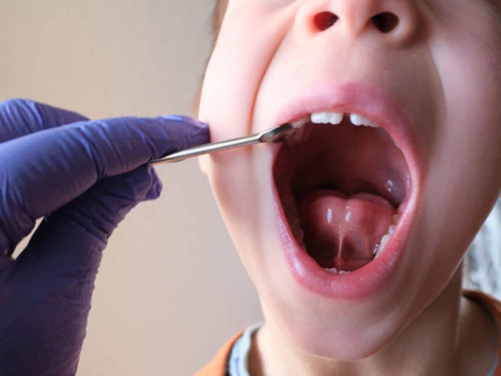 Dentist,,Doctor,Examines,Oral,Cavity,Of,Small,Patient,,Length,Of