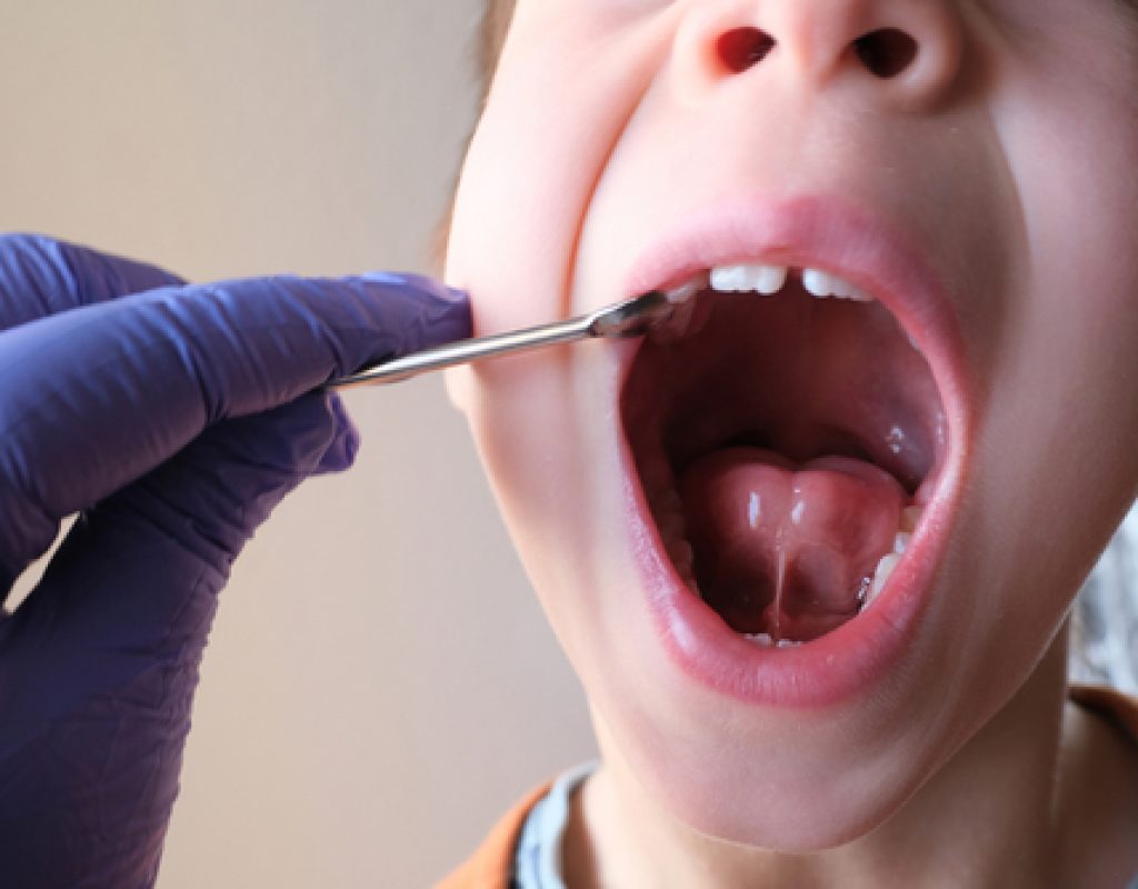 Dentist,,Doctor,Examines,Oral,Cavity,Of,Small,Patient,,Length,Of