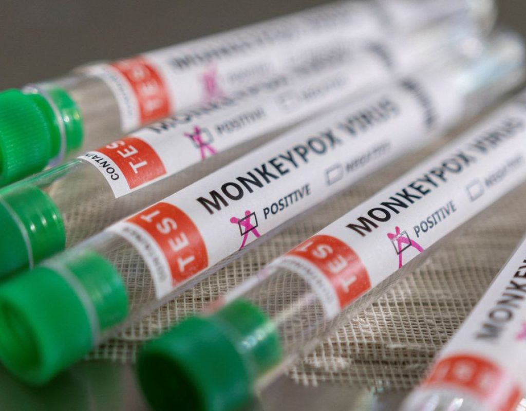 imagem-exame-monkeypox